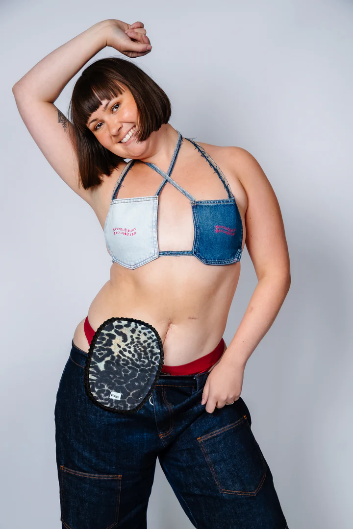 Woman wears stoma bag outside of jeans with denim bikini top